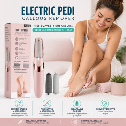 Removedor Eléctrico de Callos — ¡Pedicura Profesional en Casa sin Salón!
