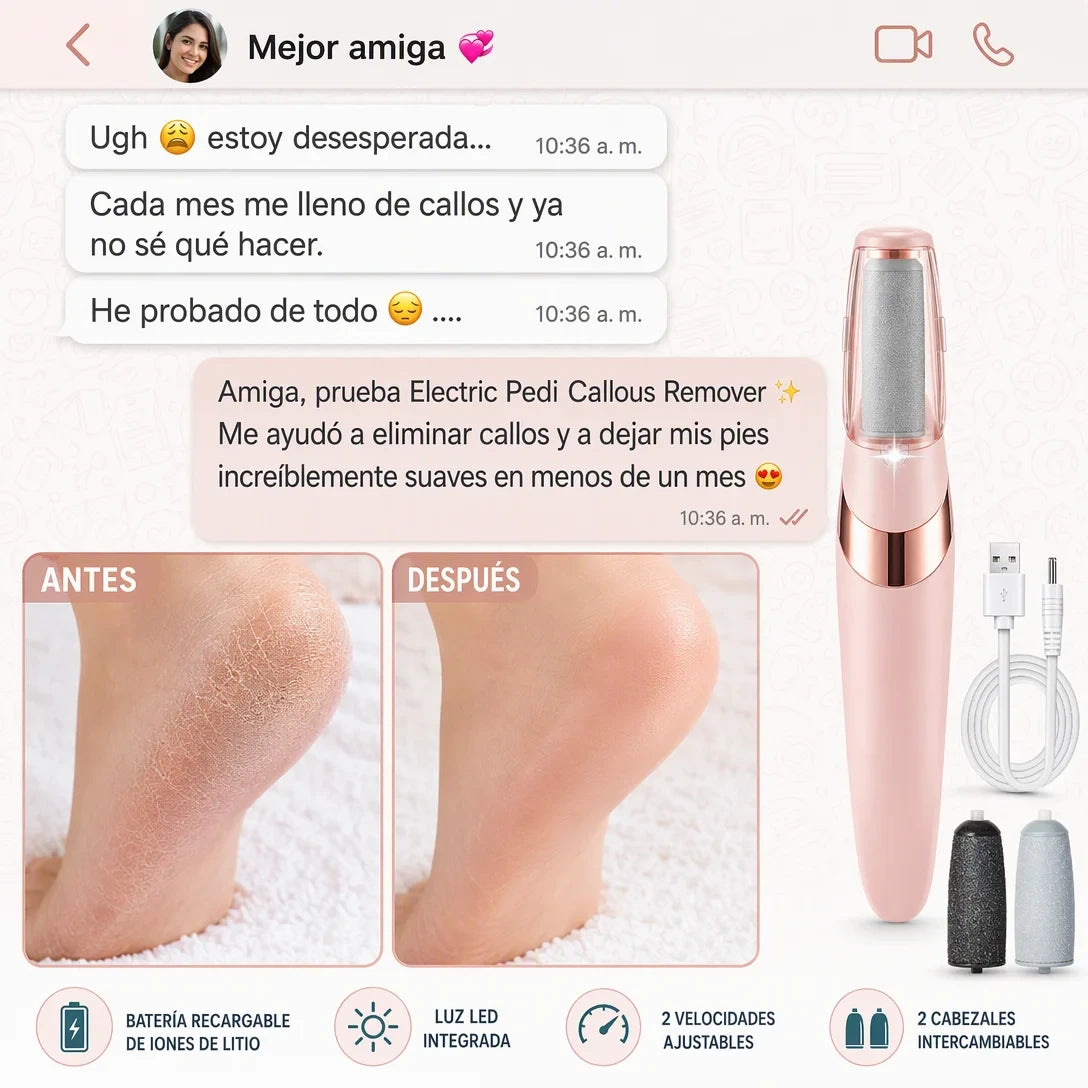 Removedor Eléctrico de Callos — ¡Pedicura Profesional en Casa sin Salón!