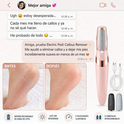 Removedor Eléctrico de Callos — ¡Pedicura Profesional en Casa sin Salón!