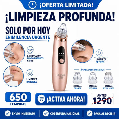 ClearSkin Pro™ – Limpiador Facial de Puntos Negros con Succión Eléctrica