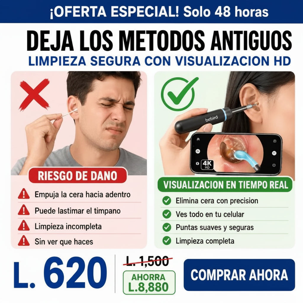 LIMPIADOR DE OÍDOS CON CÁMARA 4K Y LUZ LED GARANTÍA Y CERTIFICACIÓN - Inversiones Alkosto